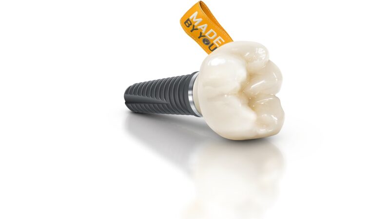 cerec, guide, made by u, cerec, cerec, cerec, cerec, cerec