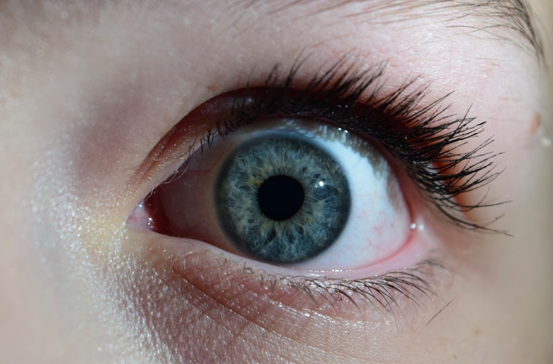 How to Treat One-Sided Popeye in Aquarium Fish